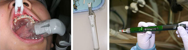 Pediatric Dentistry Technologies