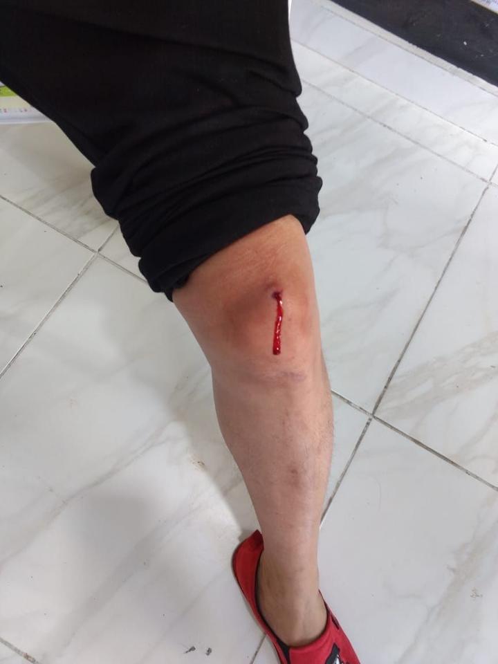 华人超市又现枪击案!一名中国男子腿部中枪