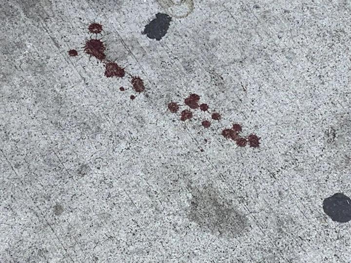 华人区小酒铺遭抢女店员被枪击现场血迹斑斑