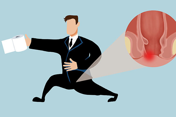 痔疮出血量究竟有多夸张25岁有痔青年竟因严重贫血入院