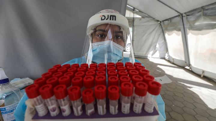 冠状病毒测试以色列卫生部周四上午报告说,周三诊断出 58,422 例新的