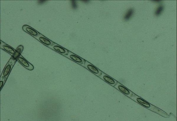 宁陕小口盘菌子囊(光学显微镜照片)宁陕小口盘菌子囊孢子(电子显微镜