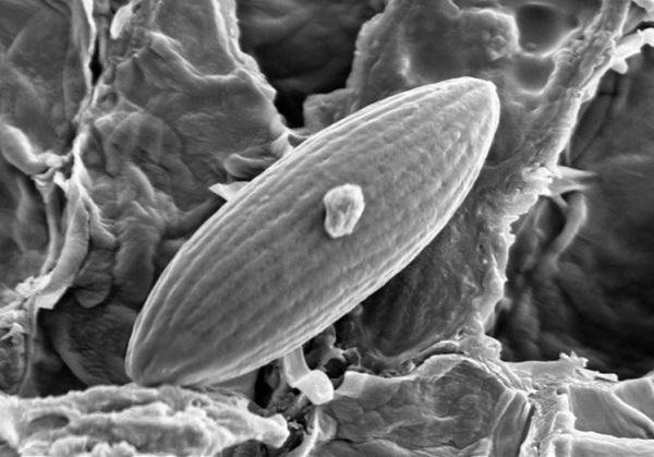 宁陕小口盘菌子囊孢子(电子显微镜照片)