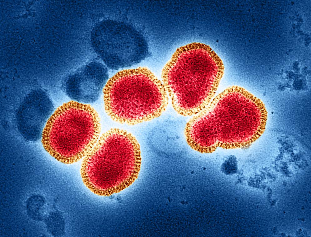 Influenza A Virus (H3N2) | Colorized transmission electron m… | Flickr