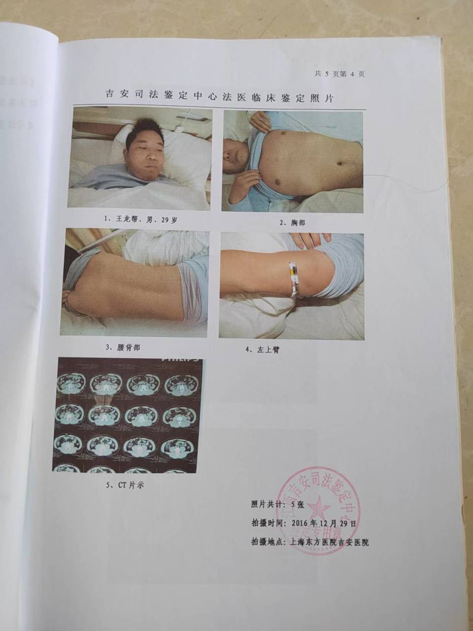 图片[10]-江西吉安：遭暴力强拆殴打致残赔偿不公 村民维权九年无果-华闻时空