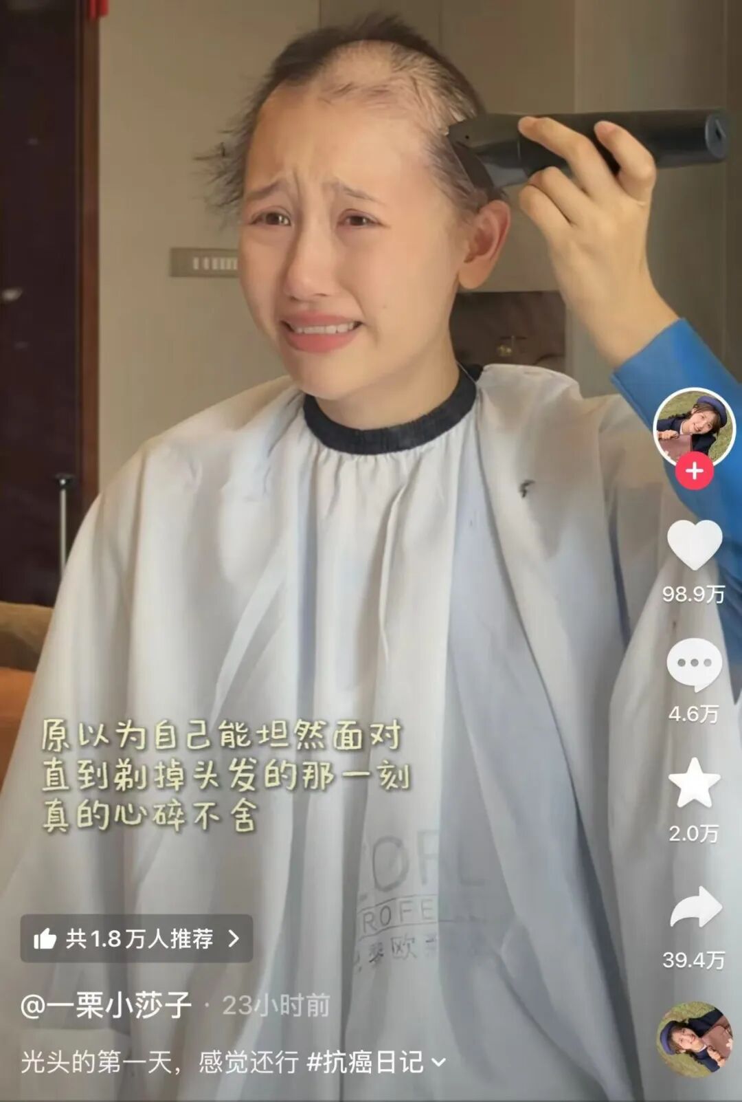 “光头的第一天感觉还行”，千万粉丝网红因癌症剃光头…这种瘤的“足迹”遍布全身_全球_新闻_华人头条