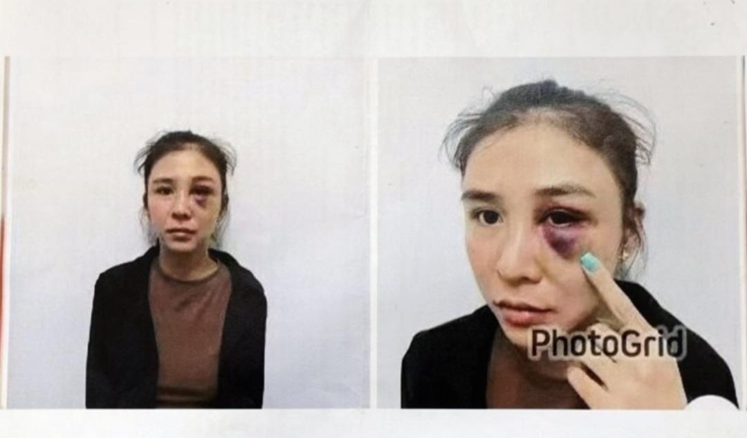 越南女子马来西亚夜店遭枪威胁　疑被逼携毒品行李箱离场